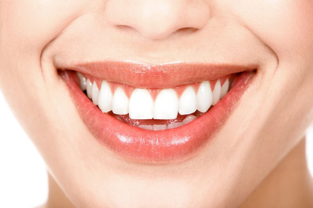 Blanqueamiento dental