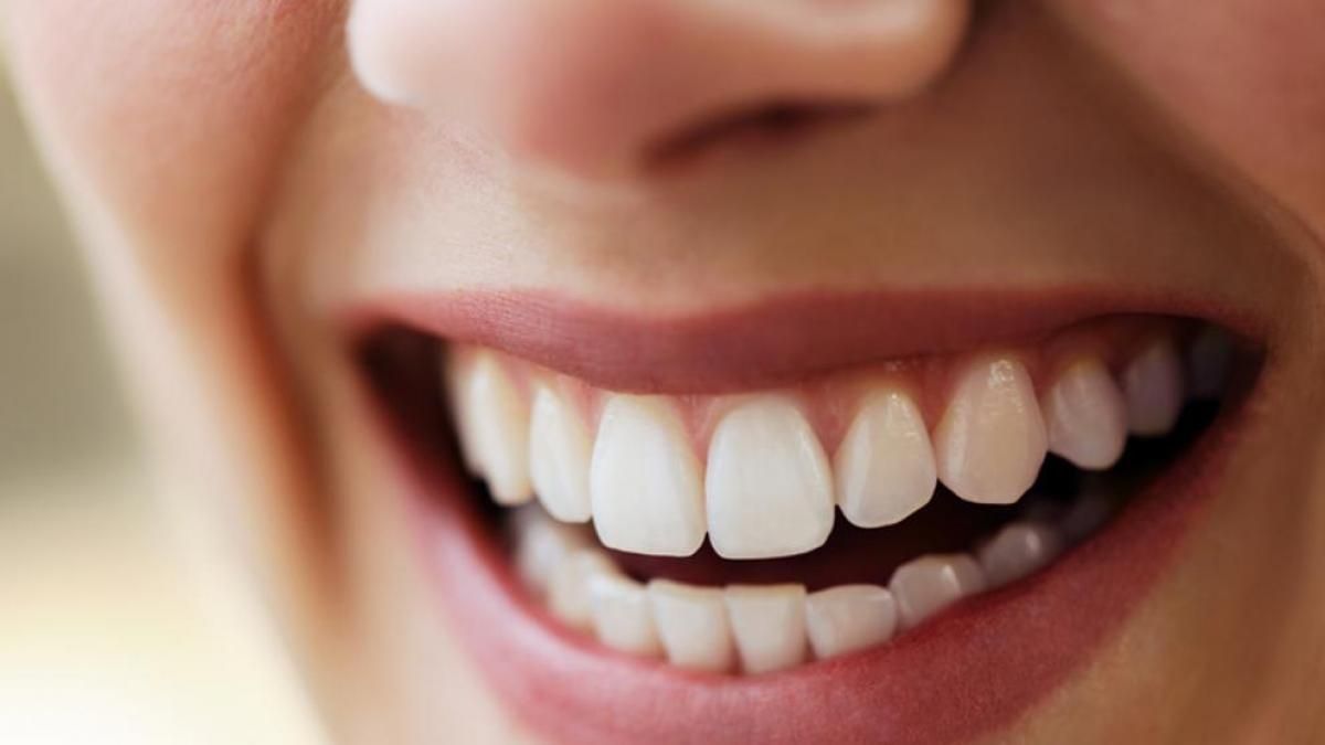 10 cosas importantes antes de blanquear tus dientes