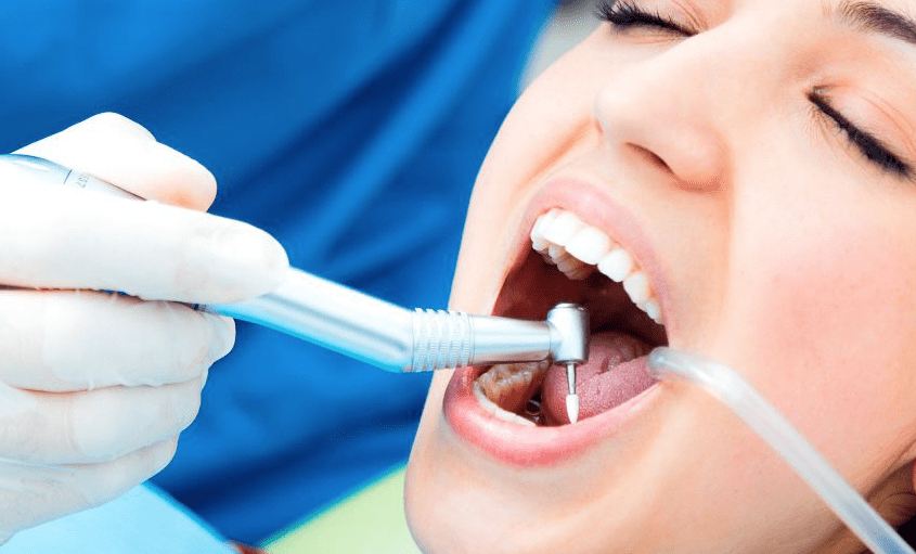 tratamiento de endodoncia a una paciente