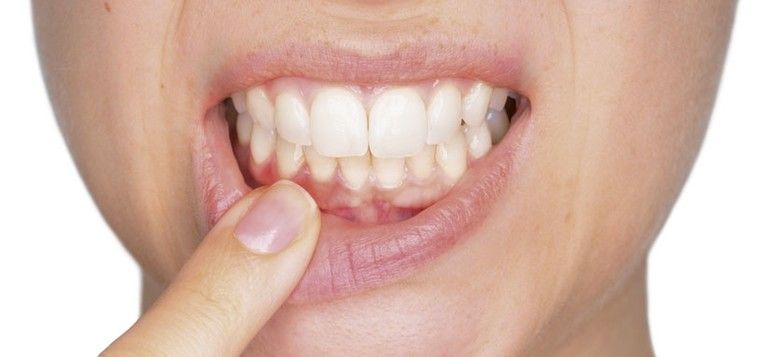 Tratamiento y estudio periodontal